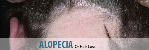 Best Homeopathic Medicines for ALOPECIA & BALDNESS Treatment
