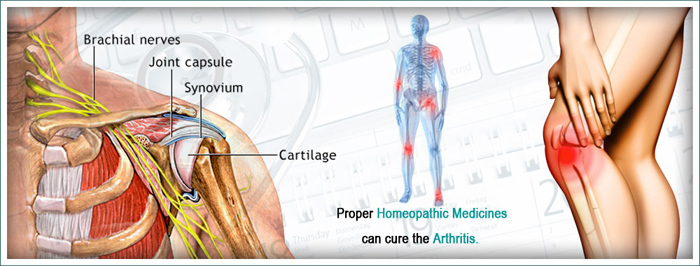 6 Best Homeopathic Medicines for Arthritis, Joints Pain, Rheumatism